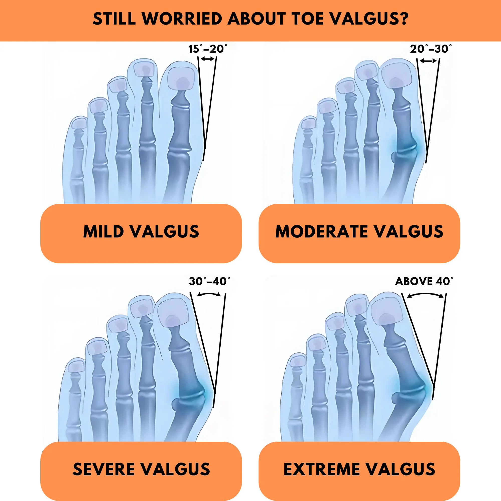 Orthopaedic Toe Bunion Corrector - Image 8